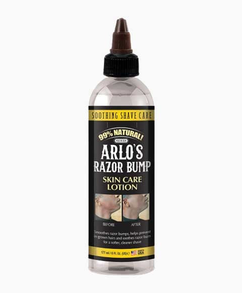 Arlos Razor Bump Skin Care Lotion