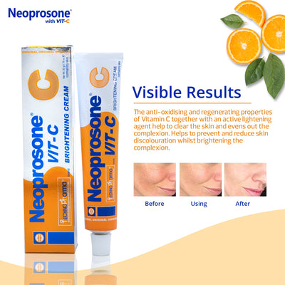 Mitchell Neoprosone Brightening Cream with Vitamin C 50g