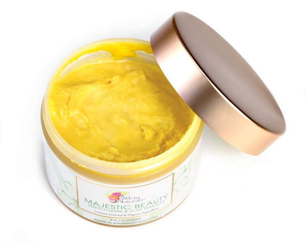 Alikay Naturals Majestic Beauty Stretch Mark And Scar Remover 236ml