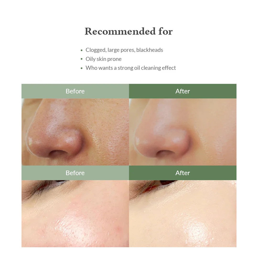 Dr Althea  Premium Quick Step Sebum Cleanser