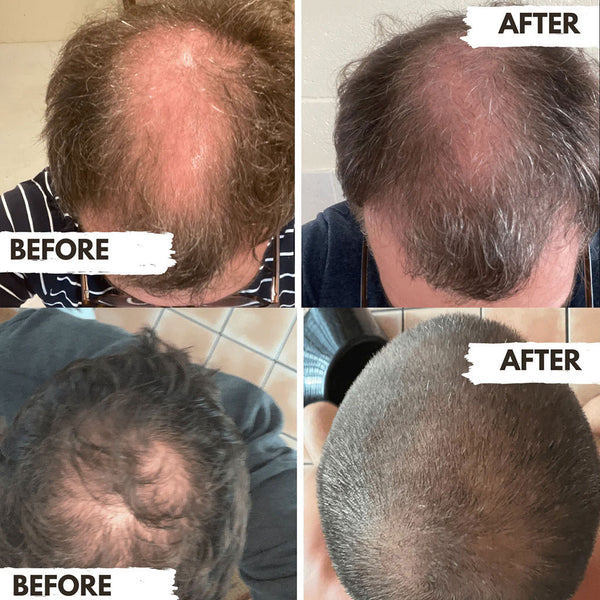 Regrow  Shampoo For Men