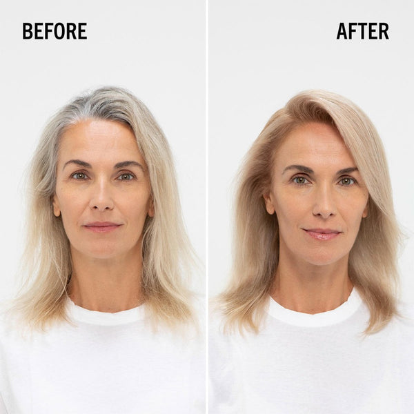 Schwarzkopf  Blondme Blonde Lifting Upto 5 Levels